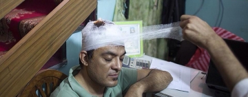 د عبداالله عبدالله د موټرو په کاروان باندې تروریستي حمله کې یو خبریال، یو عکاس او یو انځورګر ټپي شول.